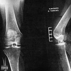 Torn Acl