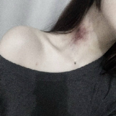 мой дом гниет