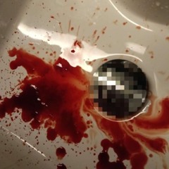 FROGG UNTRE ( WOAH )