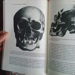 LA PROFANACION DE UN MUSEO AL AIRE LIBRE Y UNA JORNADA DE LEISHMANIA