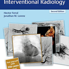 DOWNLOAD EPUB 💌 RadCases Q&A Interventional Radiology (Radcases Plus Q&A) by  Hector