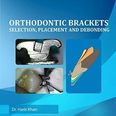 [ACCESS] [KINDLE PDF EBOOK EPUB] Orthodontic Brackets: Selection,Placement and Debond