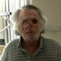 Face-Eating Cannibal Attack May Be Latest in String of 'Bath Salts' Incidents