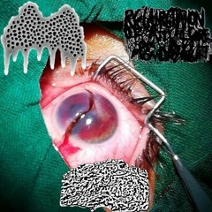 Genocidal Evisceration