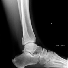FEET - Woo.