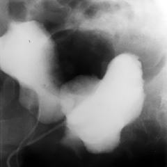 I Can’t Live in a Living Room