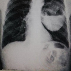 Dead Lungs (prod. xvesugeo)