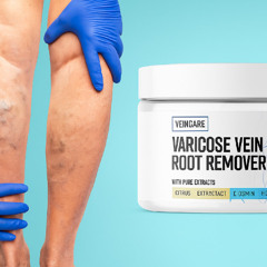 Veincare Varicose Vein Root Remover Australia: Reviews, Price, Benefits, Ingredients, Amazon & Where to Buy?