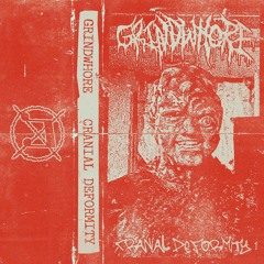 Cranial Deformity