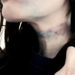 даю ей ссадины)