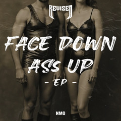 NMO - Keep It Low