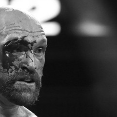 Tyson Fury x I Had No Youth Life