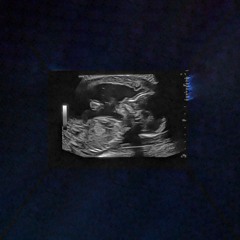 BABYHEART