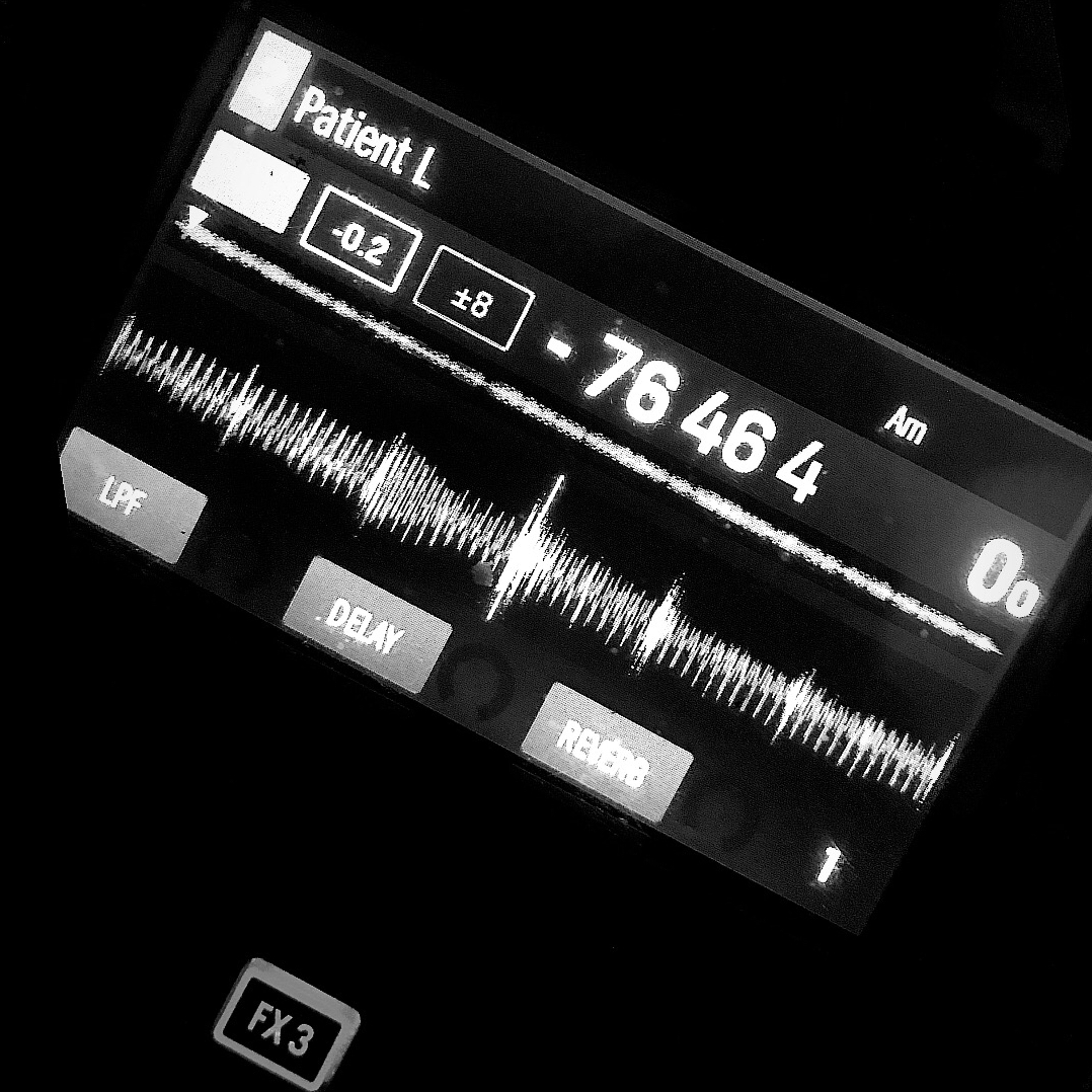 Patient L (Ethno-Downtempo - Tracklist in Description)
