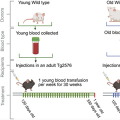 Young and Old Mice Blood Differently Shapes Alzheimer’s-Related Brain Changes