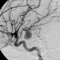 [FFNP] 'brain decline' [PROD. PSVCH]