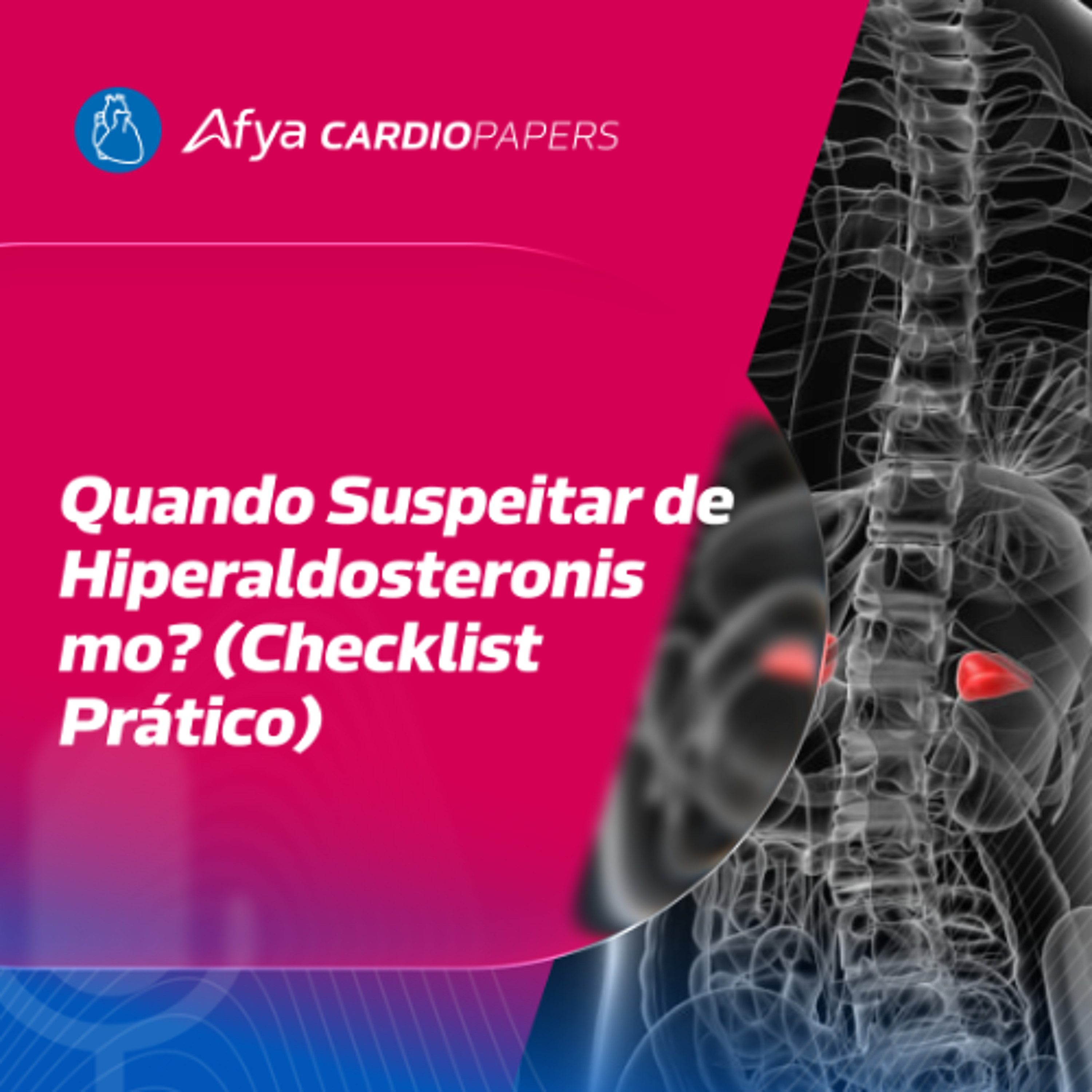 Hiperaldosteronismo: Quem Deve Ser Investigado?