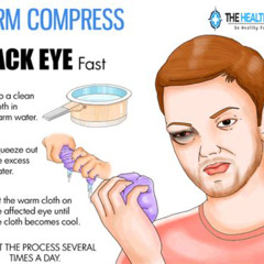Best Swollen Black Eye Treatment Reviews