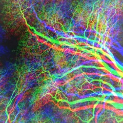 Lysergic (FORTHCOMING GNBTS)