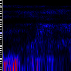 ultrasound file 4m023m49