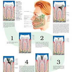 free EBOOK 💜 Tooth decay e chart: Full illustrated by  HC-HealthComm KINDLE PDF EBOO