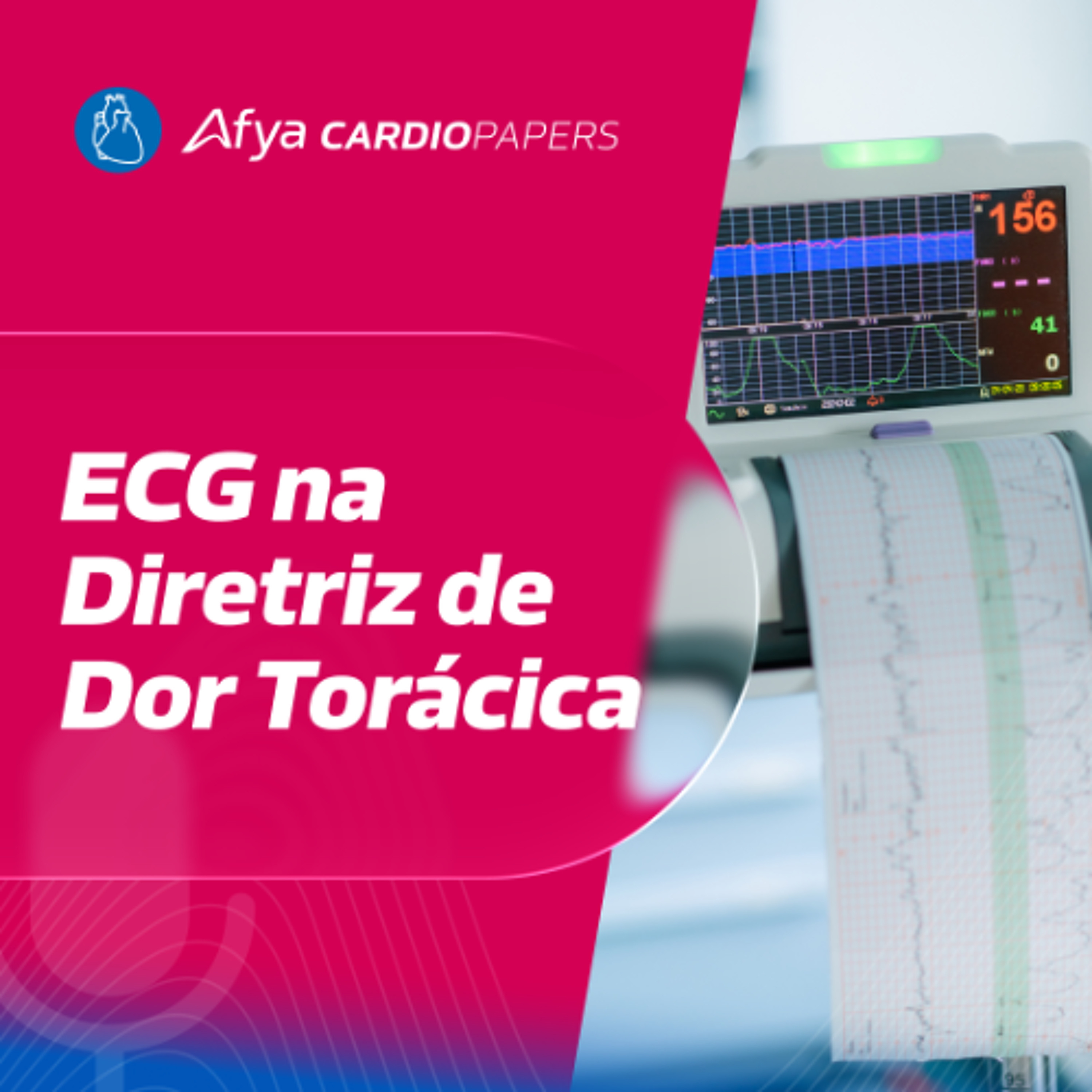 ECG isquêmicos na Diretriz de Dor Torácica