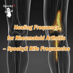 Healing Frequency for Rheumatoid Arthritis – Spooky2 Rife Frequencies