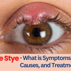 Best Treatment For Stye In Your Eye Reviews