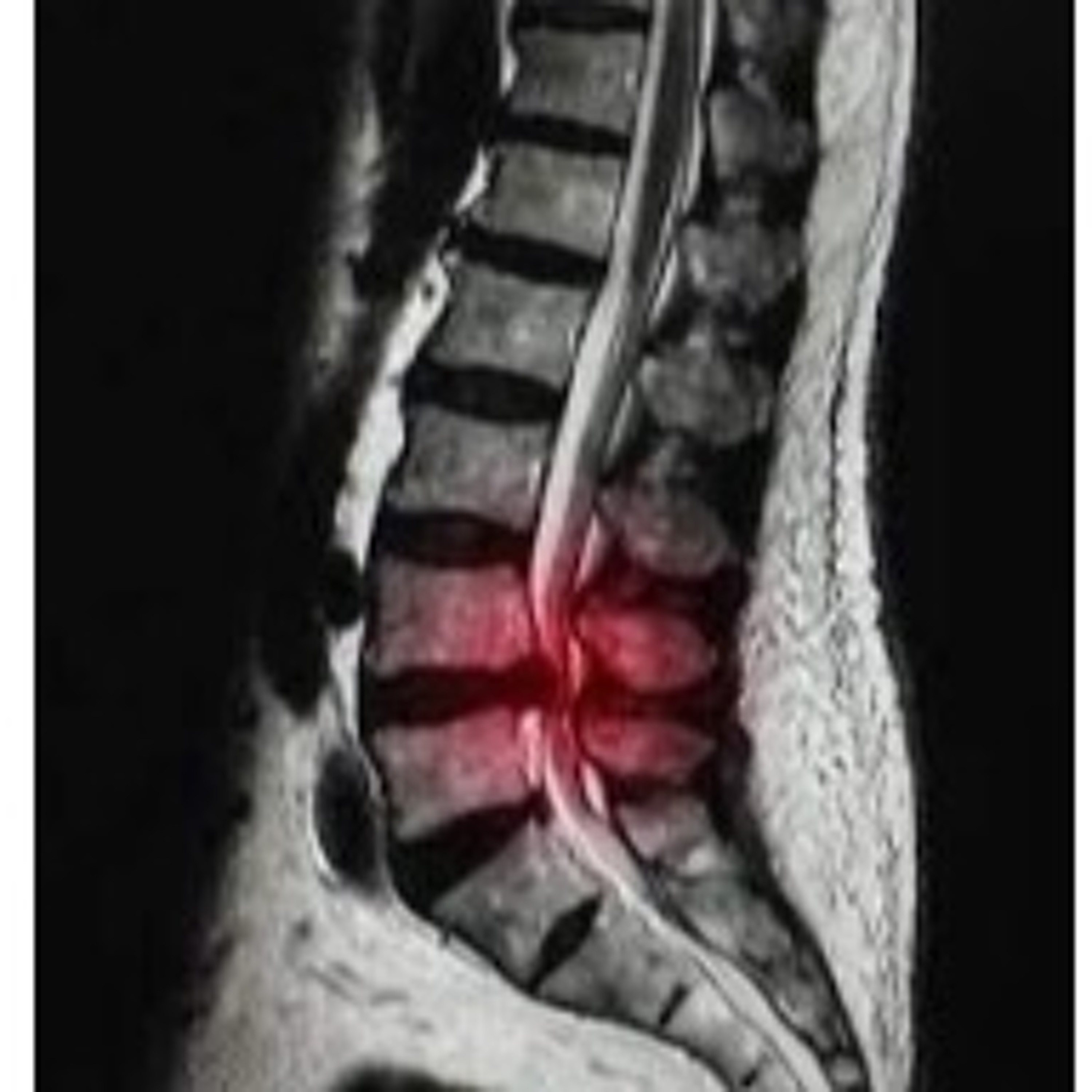 Dr Michael and Dr Conner talk about the trauma of bulging discs episode artwork