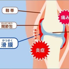 恐怖！爆発する膝腰肩