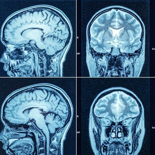 Stream step by step ct scan pdf free download exclusive from joy 