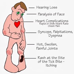 palpitating to the bank w/ crisis