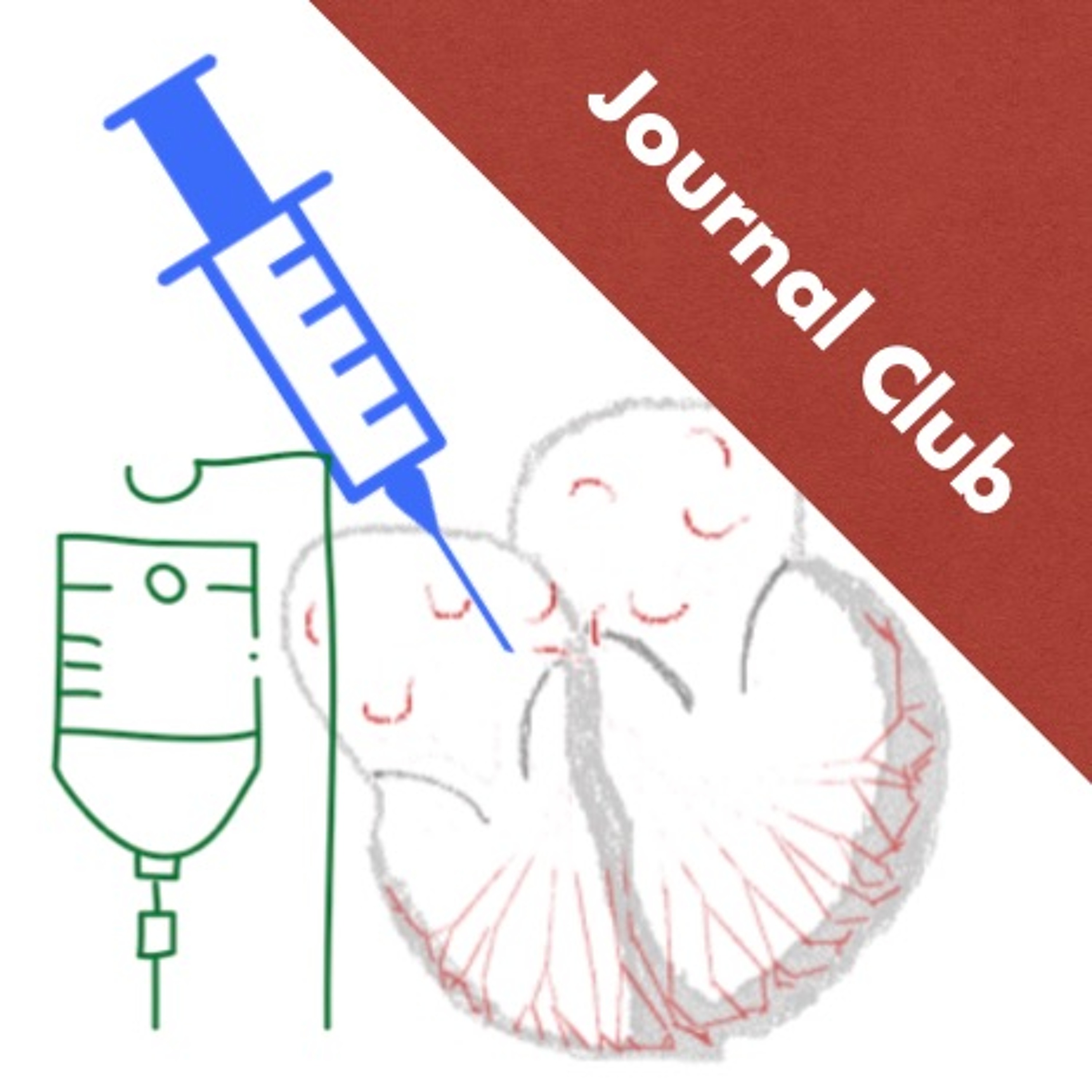 IV Metoprolol vs Diltiazem for A fib with Concomitant Heart Failure episode artwork