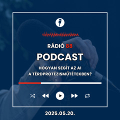 Hogyan segít az AI a térdprotézisműtétekben? | Café88 [2025.05.20.]