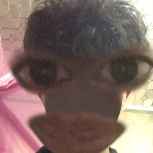 Suýt Nữa Thì Ft. Một Bước Yêu Vạn Dặm Đau - Thanh Trungg Remix