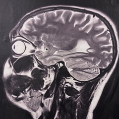 Das Ende vom Anfang 158-175