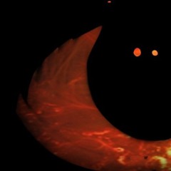 EYES ON FIRE