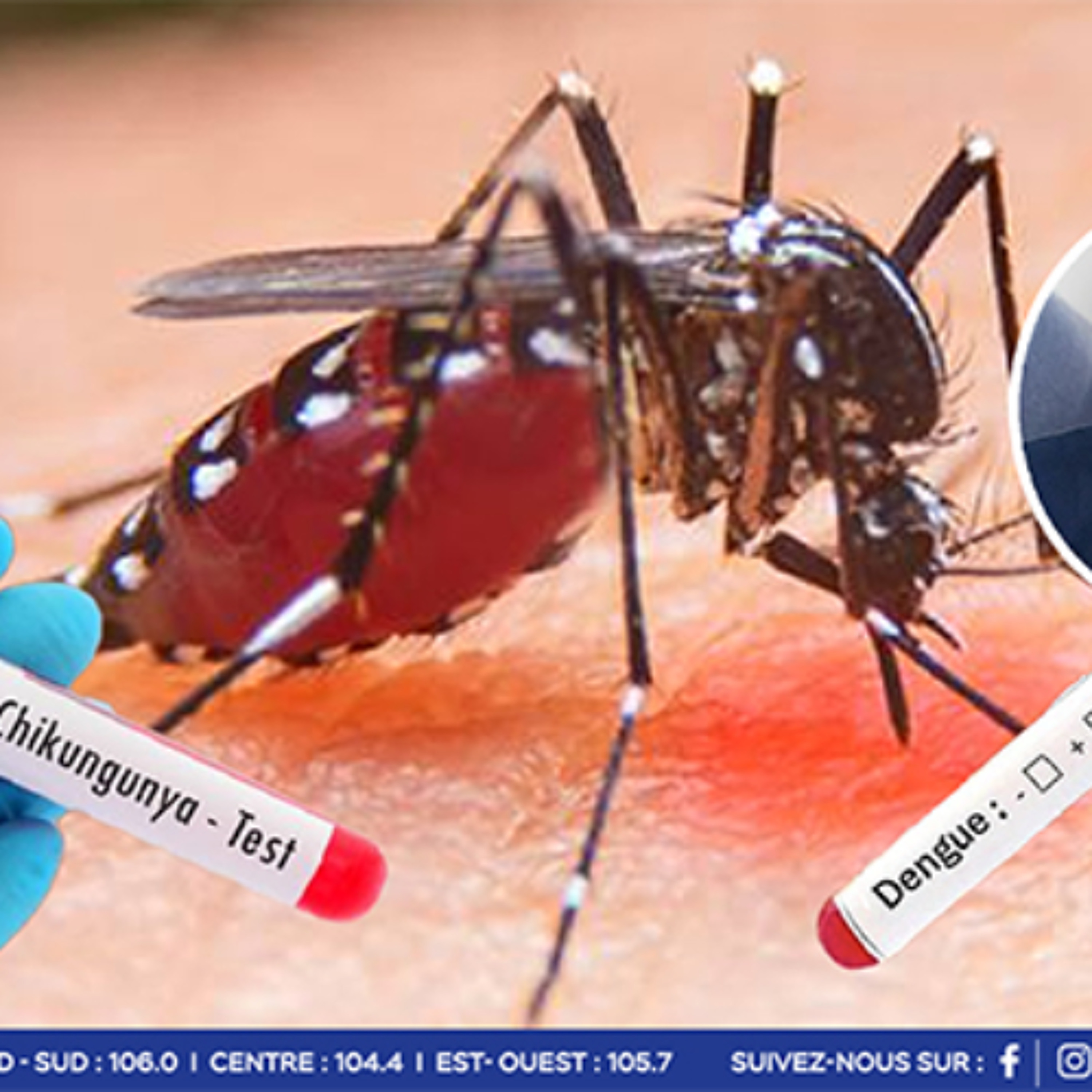 Santé : « Il ne faut pas banaliser le Chikungunya et la dengue, car ils peuvent causer de sérieux problèmes de santé », affirme le Dr Fazil Khodabaccus.