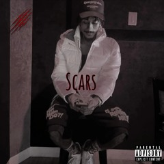 Scars