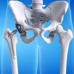 Orthopaedic