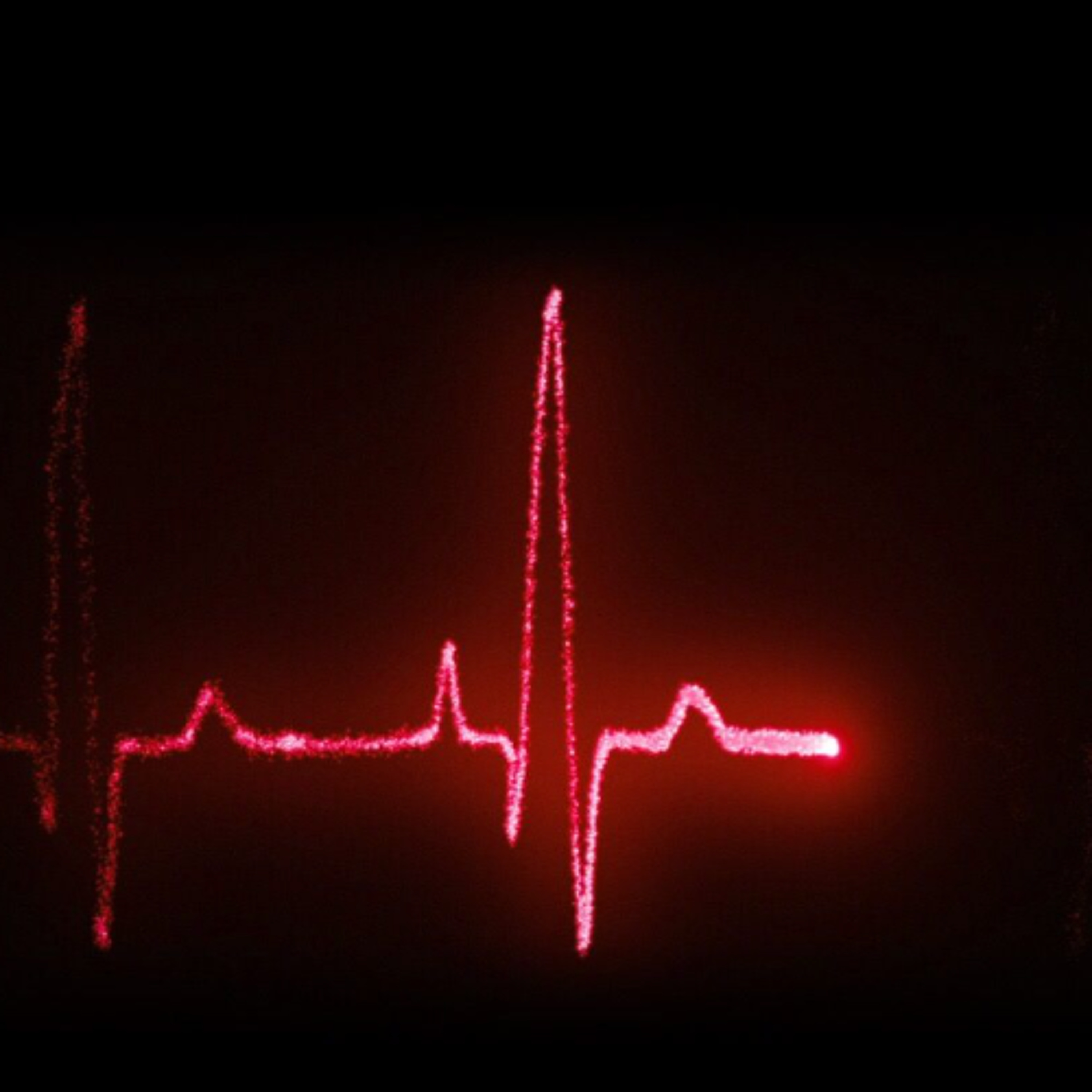EKG episode artwork