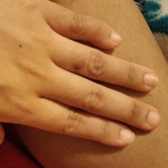 lise9lac by Stagmongkeya