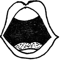 fear of rejection (DEMO)