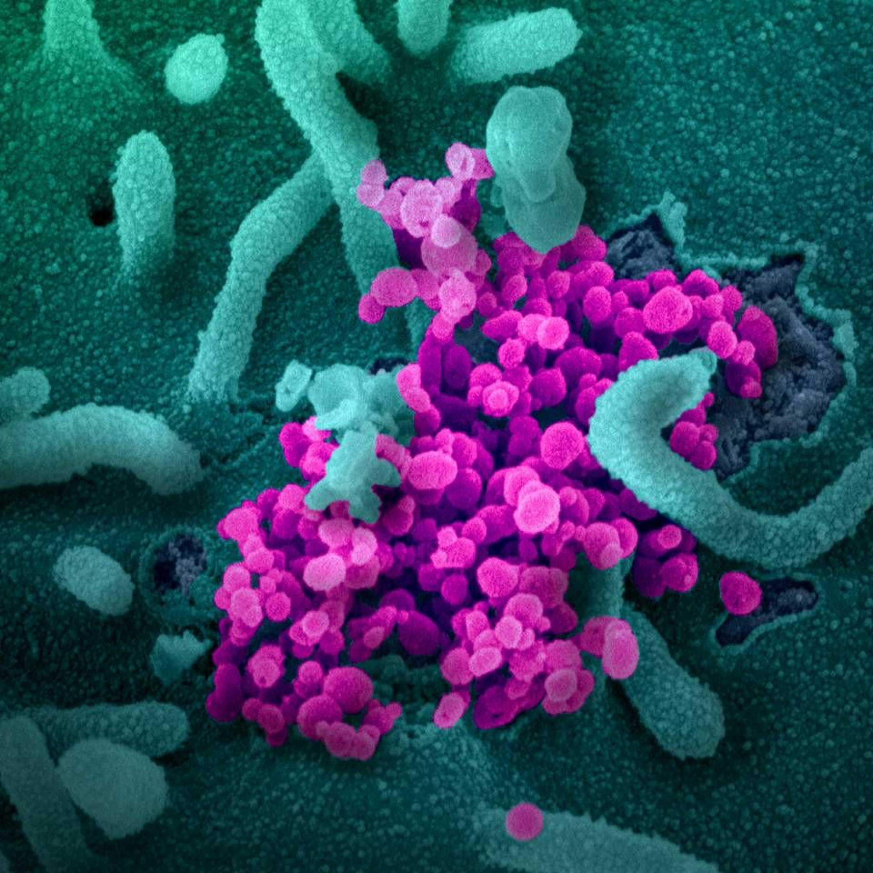 n=43 COVID-19 Vaccines: Our shot at immunity from SARS-CoV-2