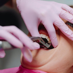 Do’s and Don’ts After Removing Wisdom Teeth in San Francisco
