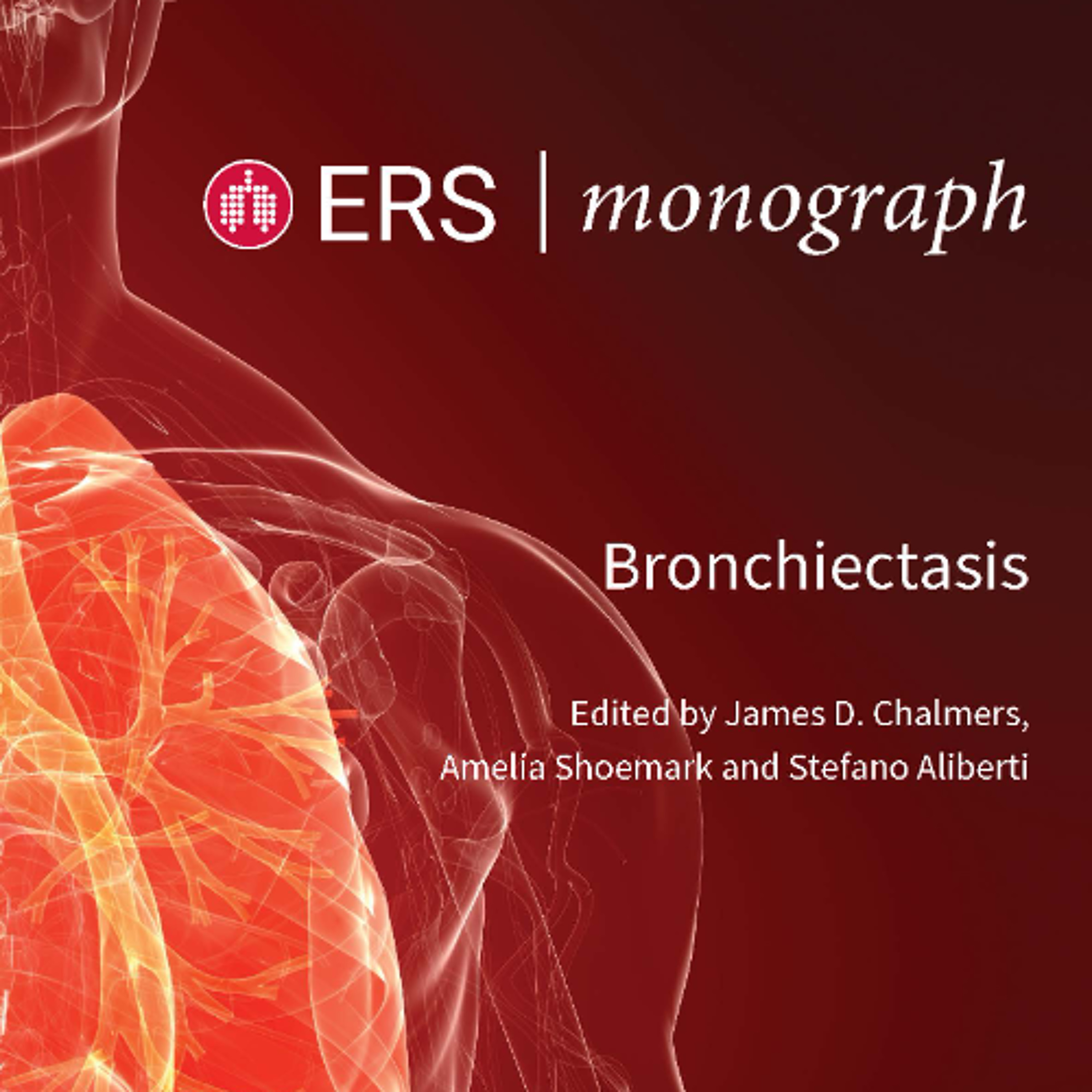 Bronchiectasis