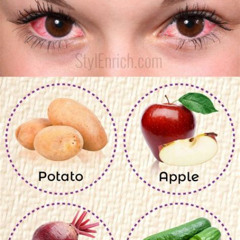 Best Under Eye Irritation Treatment Reviews