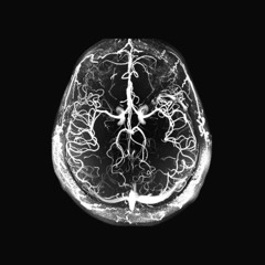 in my brain! (spotify - sliick!)