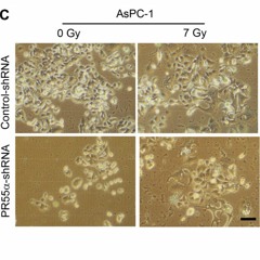 PR55α-controlled PP2A Inhibits p16 Expression and Blocks Cellular Senescence Induction