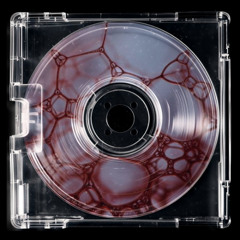 when i bleed (prod. shockey)